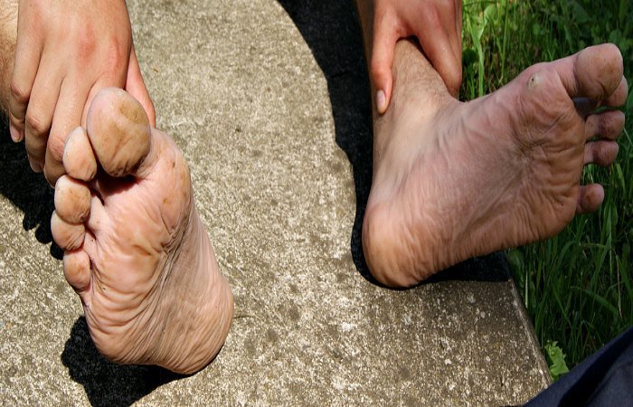 Feet